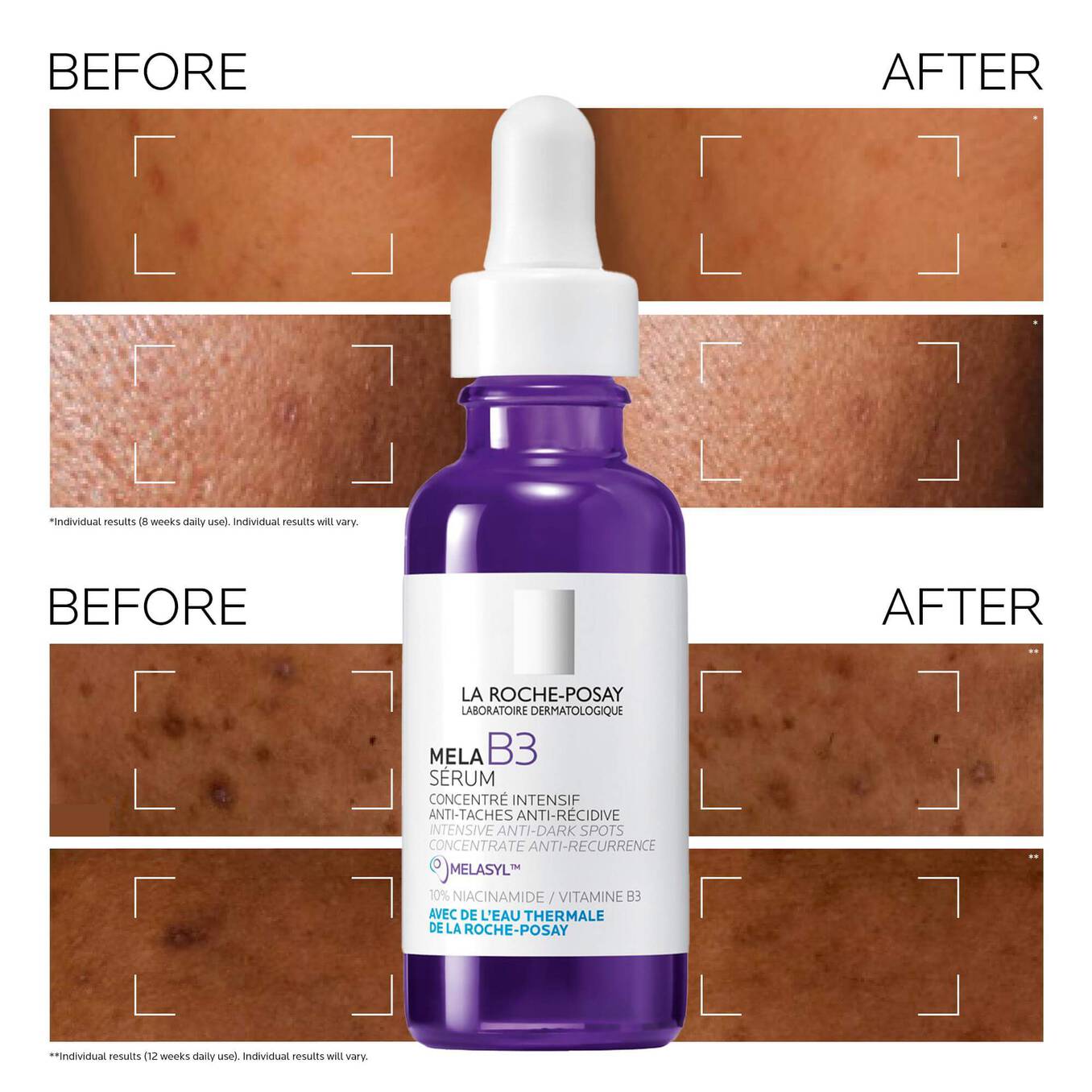 LA ROCHE POSAY Mela B3 Intense Anti-dark spot serum 2