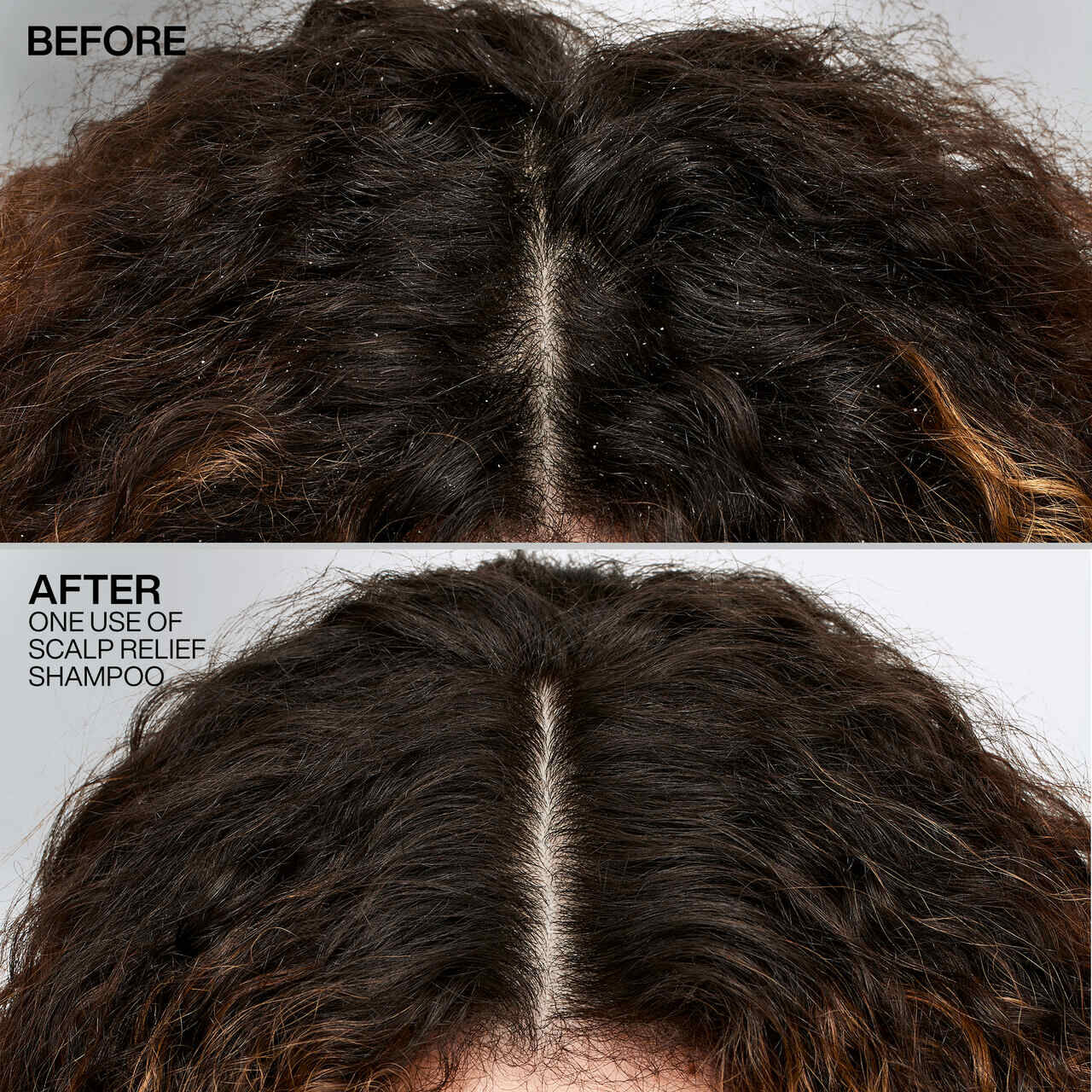 REDKEN DANDRUFF CONTROL SHAMPOO 2